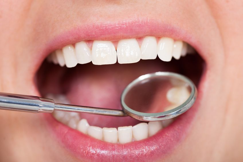 dental-checkup