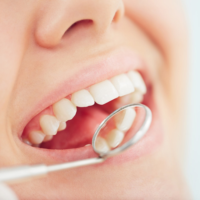 dental-exam